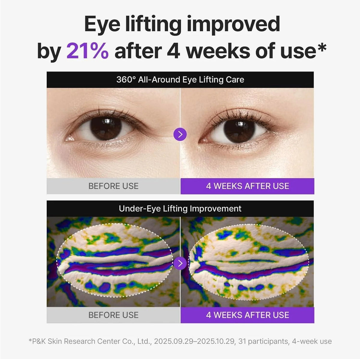 Centellian24 : 360º Shot PDRN Lifting Eye Cream