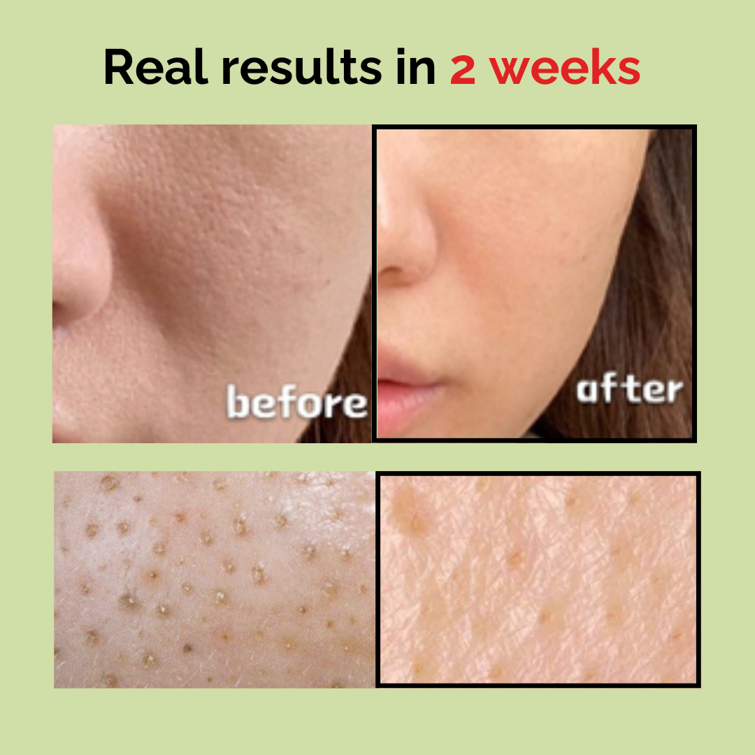 mommy care : Sea Grape Pore Refining Ampoule