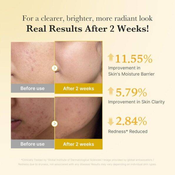 medicube : Kojic Acid Turmeric Niacinamide Serum