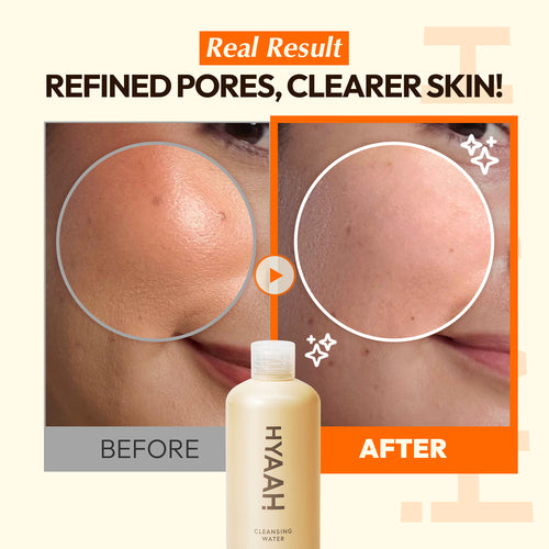 HYAAH : Mild But Deep Cleansing Water