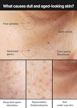 celimax : Pore+Dark Spot Brightening Cream
