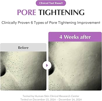EQQUALBERRY : Purple PDRN Pore Minimizing Serum