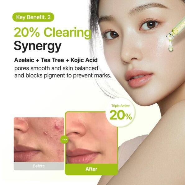 Purito SEOUL : Azelaic Acid 10 Kojic Tea Tree Serum