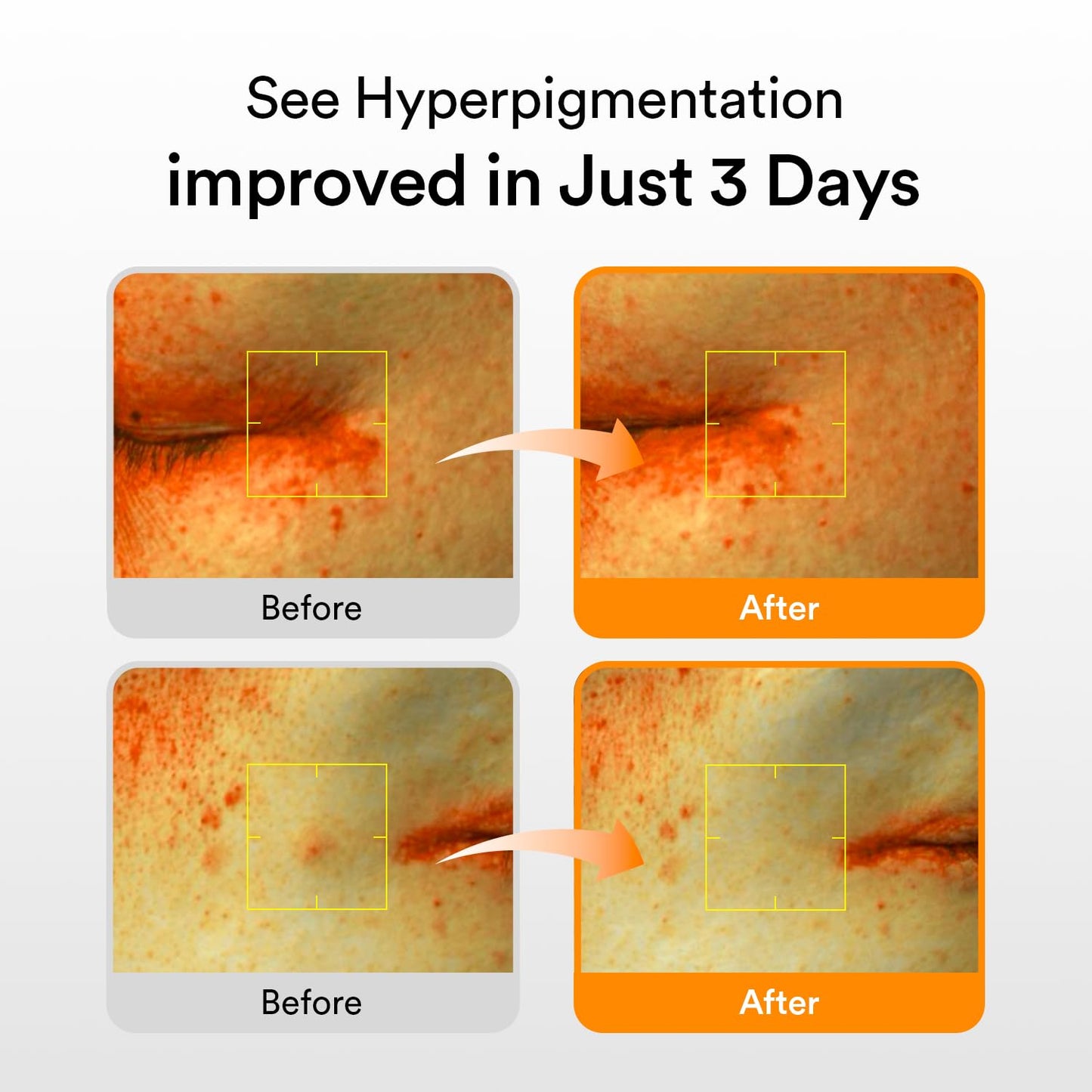 Abib : Glutathiosome Dark Spot Serum Vita Drop