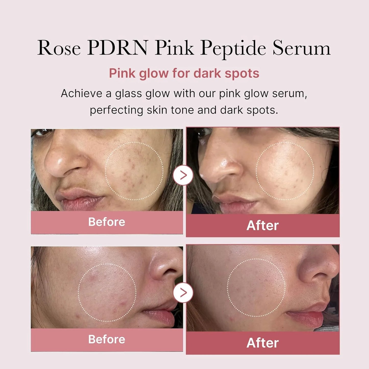 medicube : PDRN Pink Peptide Serum