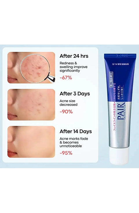 LION : Pair Acne Cream W