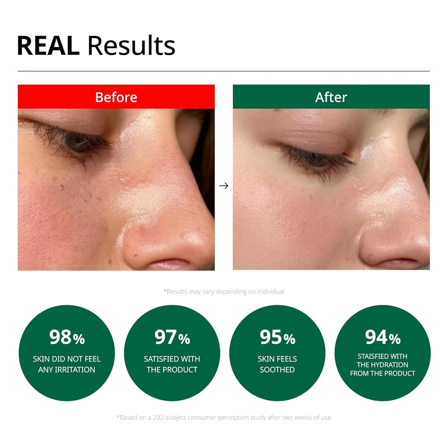 Dr.G : R.E.D Blemish Clear Soothing Cream