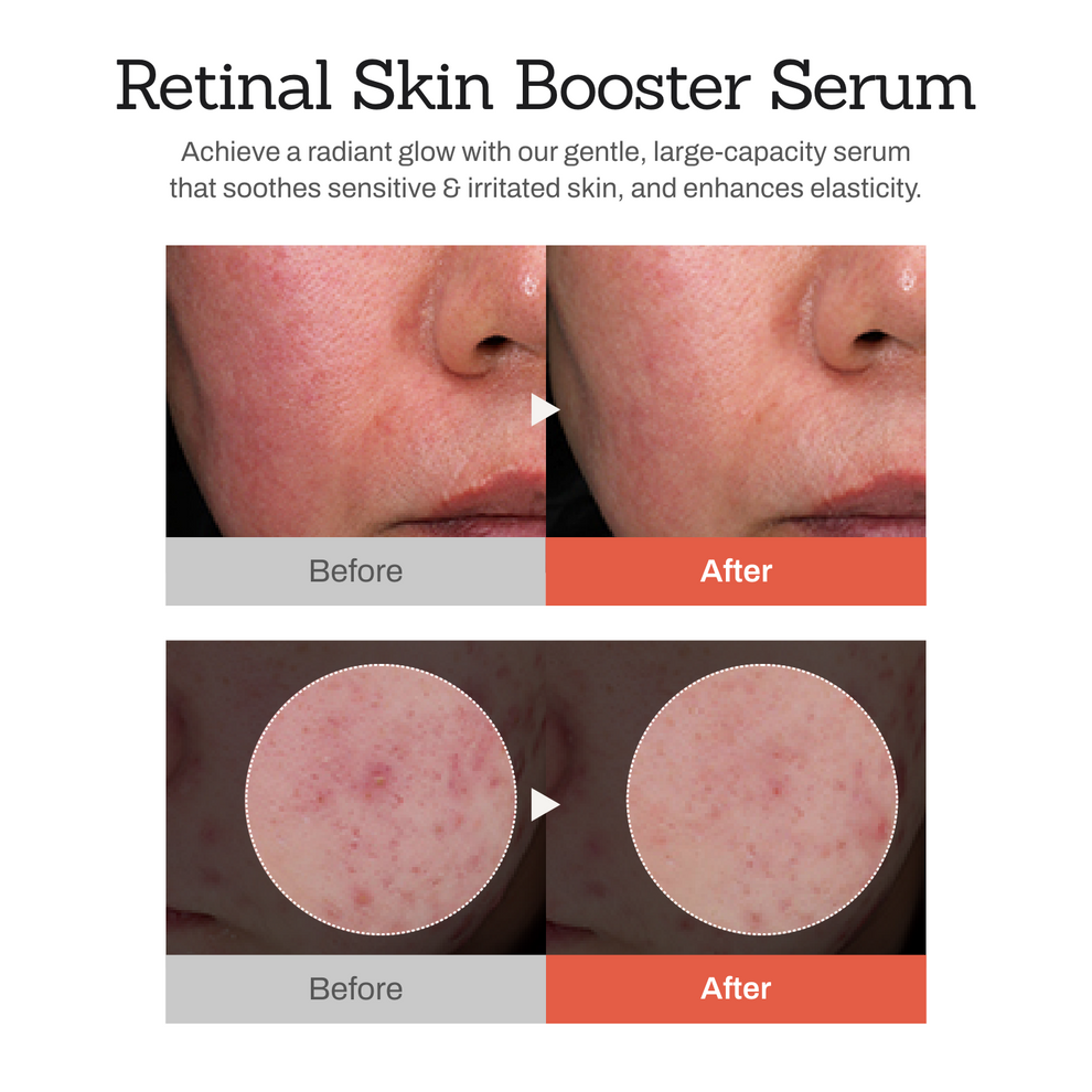 Meditherapy - Retinal Skin Booster Serum