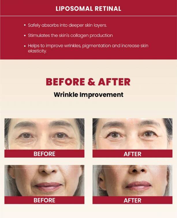 KSECRET : SEOUL 1988 Cream : Retinal Liposome 1% + Fermented Rice