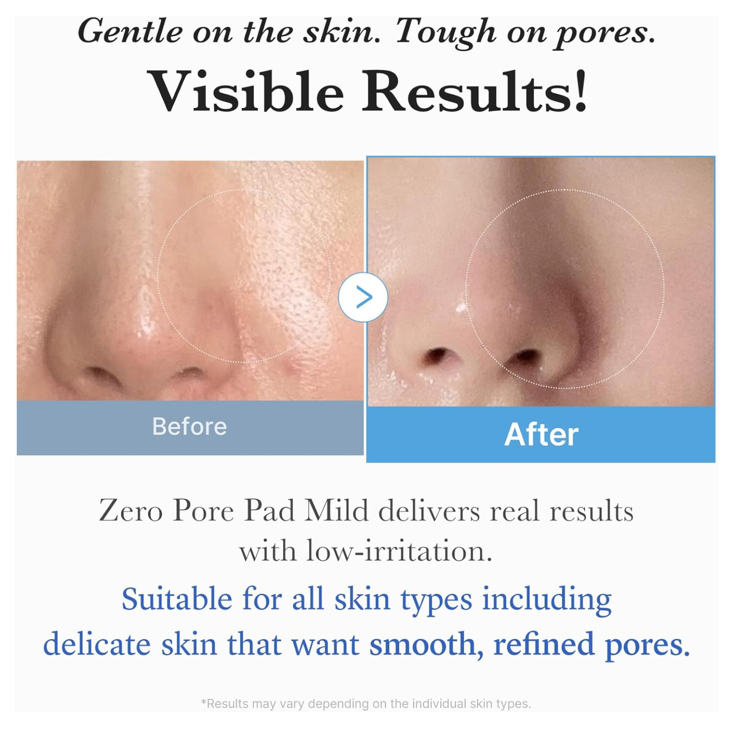 medicube : Zero Pore Pad 2.0