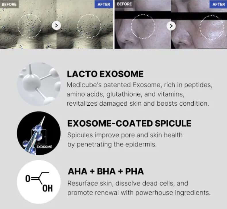 medicube : One Day Exosome Shot Pore Ampoule 7500