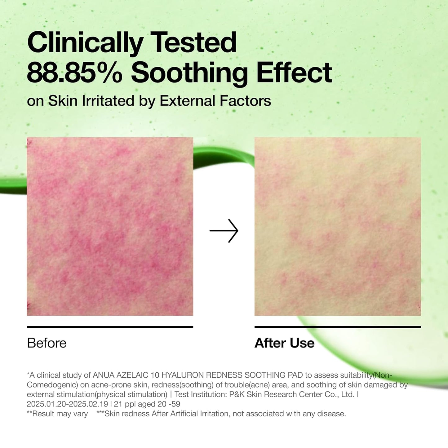 Anua : Azelaic 10 Hyaluron Redness Soothing Pad