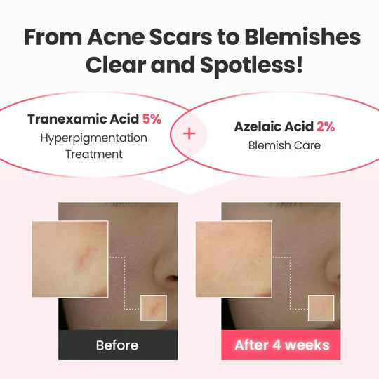 Dr.G : R.E.D Blemish Tranexamic Acid 21.5 Repair Serum