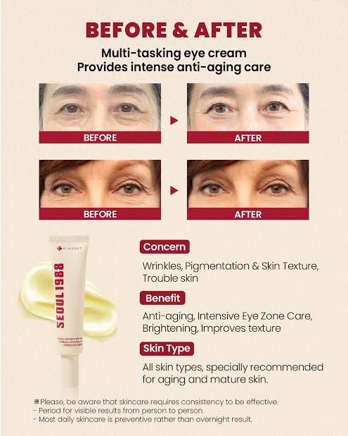 KSECRET : SEOUL 1988 Eye Cream : Retinal Liposome 4% + Fermented Bean