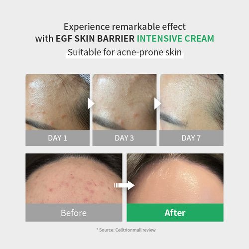 zipiderm : EGF Skin Barrier Intensive Cream